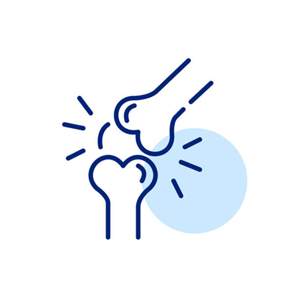 Arthritis